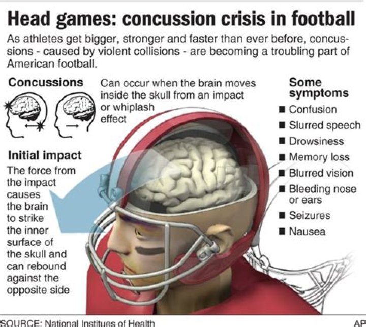 Does football cause CTE?